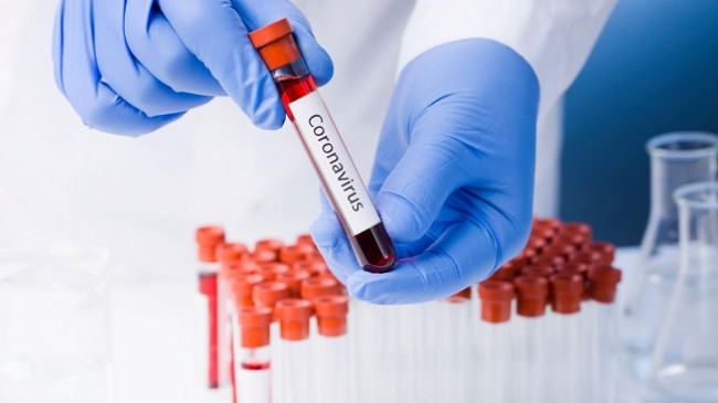 Rritet numri i të infektuarve me koronavirus në Kosovë