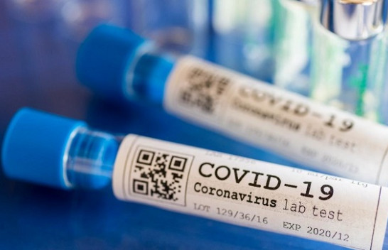 Rritet numri i infektimeve me COVID-19 në Shqipëri