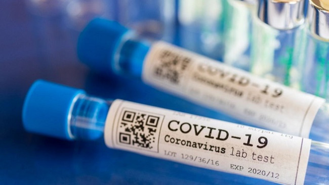 Rritet numri i infektimeve me COVID-19 në Shqipëri