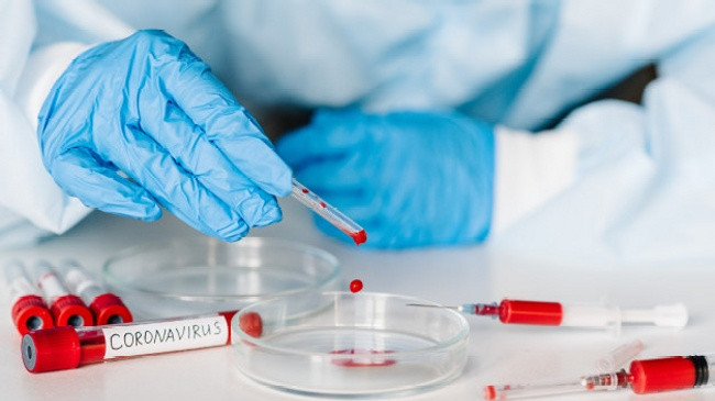 IKSHPK: 104 raste të reja dhe 42 të shëruar me koronavirus në Kosovë