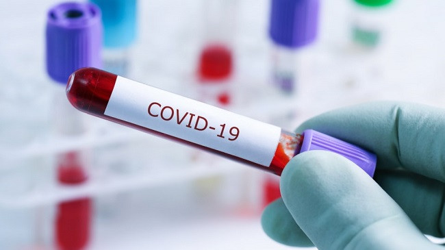 289 të infektuar në 24 orë, shifra rekord me COVID-19 në Shqipëri
