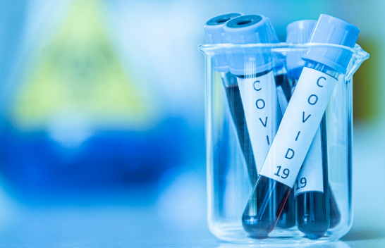 Rritje rekord e të infektuarve me koronavirus në Shqipëri