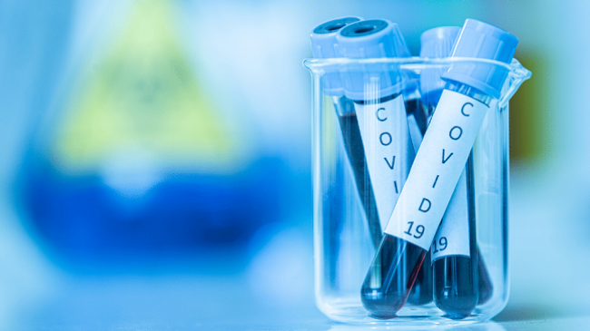 Rritje rekord e të infektuarve me koronavirus në Shqipëri