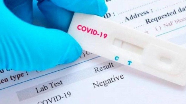 Për 24 orë, 169 raste të reja dhe 85 të shëruar me koronavirus në Kosovë