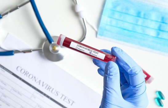 Vazhdon rritja e numrit e të infektuarve me koronavirus në Kosovë