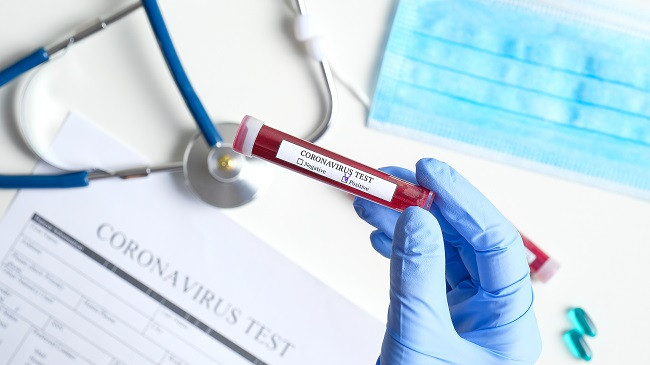 Vazhdon rritja e numrit e të infektuarve me koronavirus në Kosovë