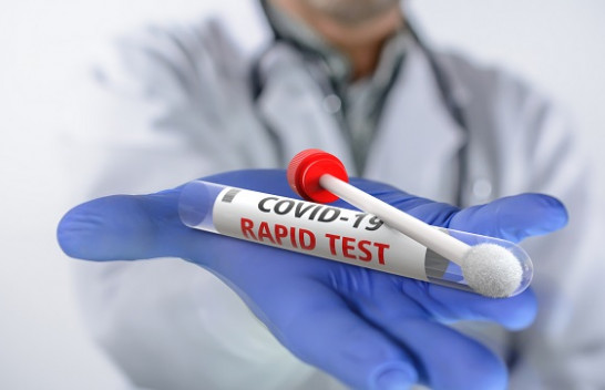 Rekord të infektuarish/ 281 raste pozitive me koronavirus në Kosovë
