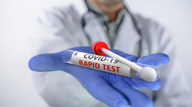 Rekord të infektuarish/ 281 raste pozitive me koronavirus në Kosovë