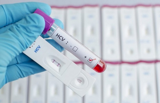 Rekord të infektuarish me koronavirus, 418 raste të reja në 24 orët e fundit në Kosovë