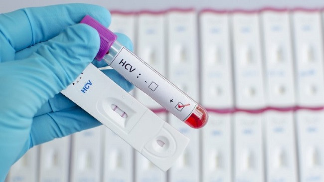 Rekord të infektuarish me koronavirus, 418 raste të reja në 24 orët e fundit në Kosovë