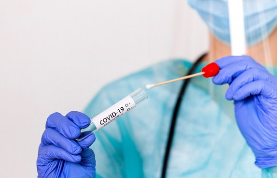 Shënohen 381 raste të reja me koronavirus në Shqipëri