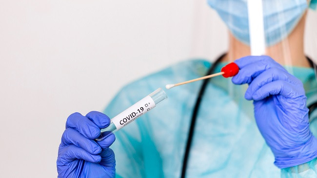 Shënohen 381 raste të reja me koronavirus në Shqipëri