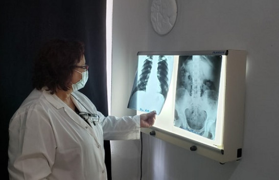 Shqipëria tjetër rekord negativ, 396 raste të reja me COVID-19