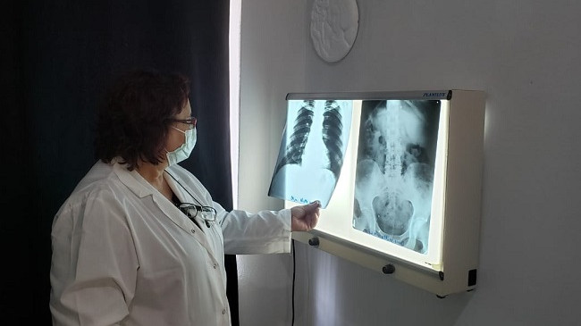 Shqipëria tjetër rekord negativ, 396 raste të reja me COVID-19