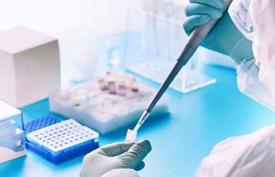 Sërish numër rekord të infektuarish me koronavirus në Kosovë