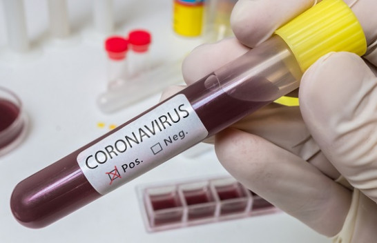 Tjetër rekord i zi, 11 të vdekur dhe 720 raste të reja me koronavirus në Kosovë