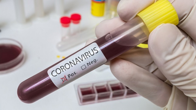 Tjetër rekord i zi, 11 të vdekur dhe 720 raste të reja me koronavirus në Kosovë