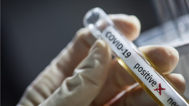 IKSHPK: 585 të shëruar dhe 521 raste të reja me koronavirus në Kosovë