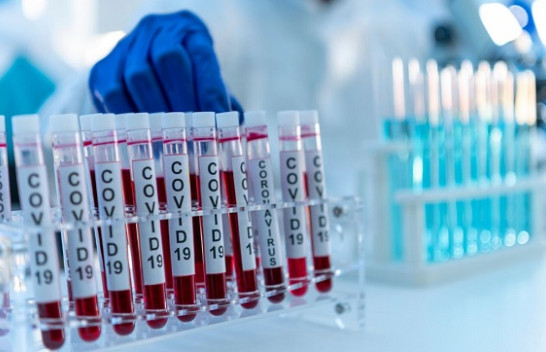 Sot 690 të shëruar dhe 478 raste të reja me koronavirus në Kosovë