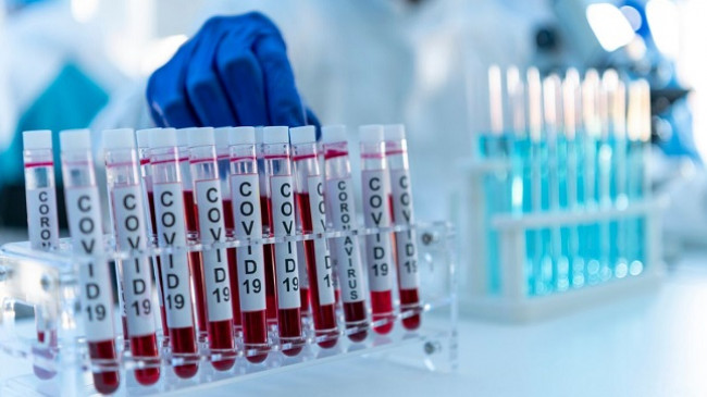 Sot 690 të shëruar dhe 478 raste të reja me koronavirus në Kosovë