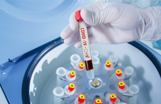IKSHPK: 678 të shëruar dhe 560 raste të reja me koronavirus në Kosovë
