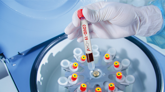 Regjistrohen 590 raste të reja dhe 696 të shëruar me koronavirus në Kosovë