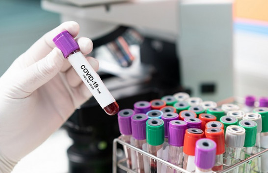 Shënohet rënie e lehtë e numrit të të infektuarve me koronavirus në Kosovë