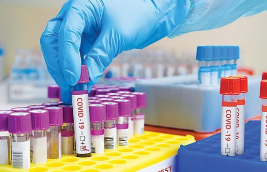 Bie numri i të infektuarve, rriten rastet e vdekjeve me koronavirus në Kosovë