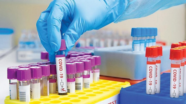 Bie numri i të infektuarve, rriten rastet e vdekjeve me koronavirus në Kosovë