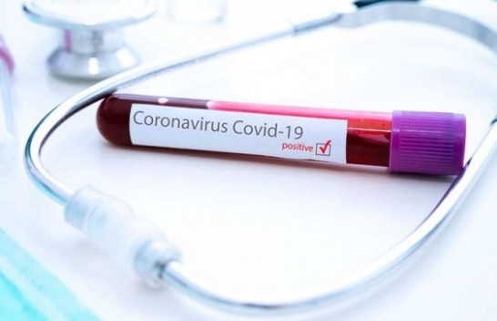 Instituti i Shëndetësisë: 319 të shëruar dhe 296 raste me COVID-19 në Kosovë