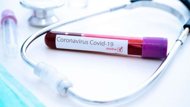 Instituti i Shëndetësisë: 319 të shëruar dhe 296 raste me COVID-19 në Kosovë
