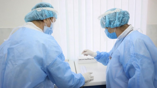 Për 24 orë, 637 raste të reja dhe 505 të shëruar me koronavirus në Shqipëri