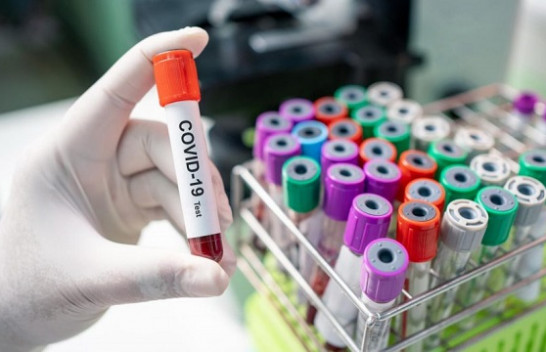IKSHPK konfirmon 453 raste të reja dhe 483 të shëruar me koronavirus në Kosovë