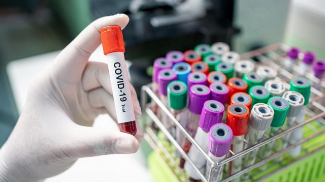 IKSHPK konfirmon 453 raste të reja dhe 483 të shëruar me koronavirus në Kosovë