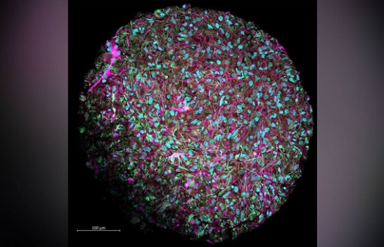 Shkencëtarët do të krijojnë një kompjuter biologjik me qeliza të njëjta me trurin e njeriut