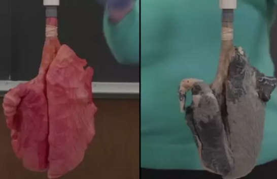 Video e tmerrshme tregon ndryshimin midis mushkërive të duhanpirësve dhe joduhanpirësve
